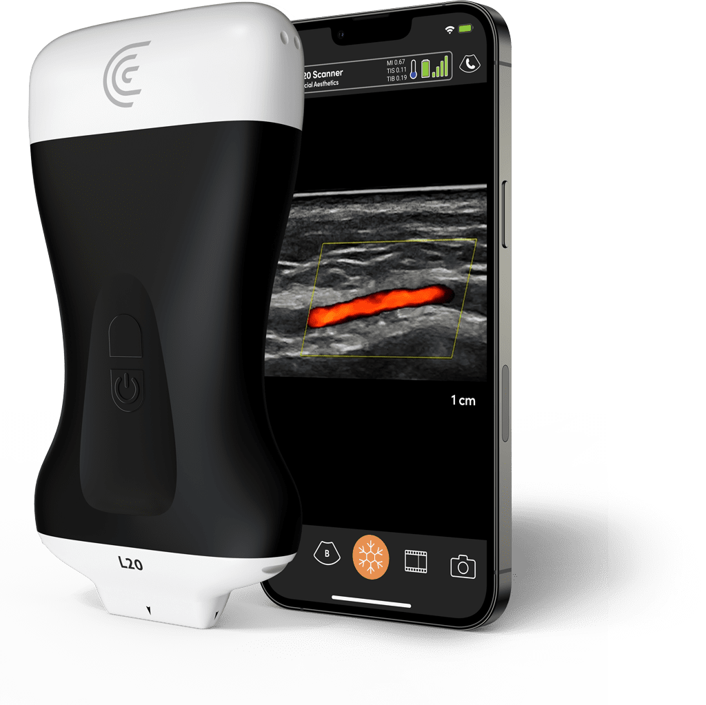 Mobile & Ultrasound Device | Movel Medical Aesthetics in Brentwood, CA