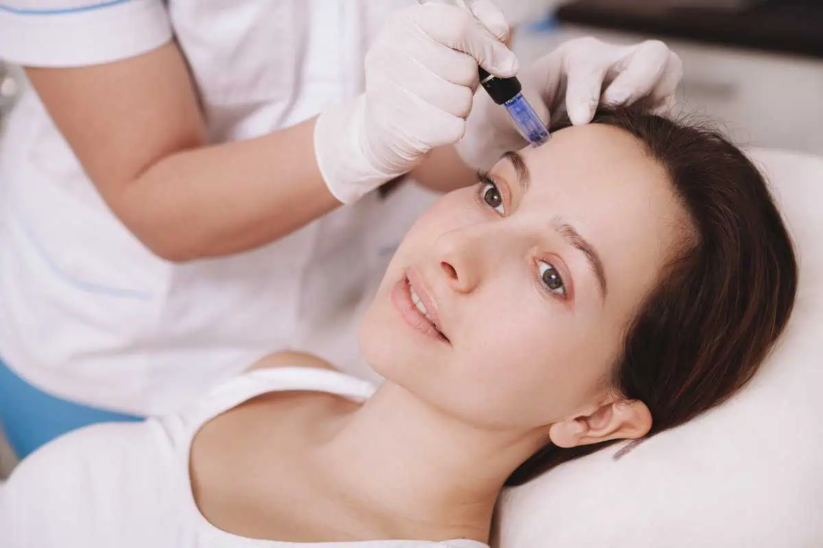 Microneedling Treatment by Movel Medical Aesthetics in Brentwood, CA